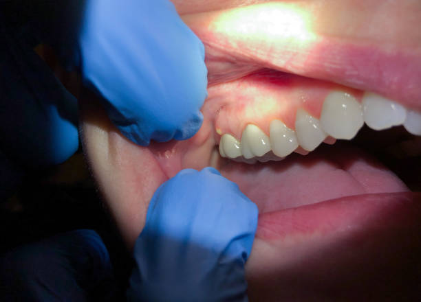 Best Walk-In Emergency Dental Services in Ashley, OH