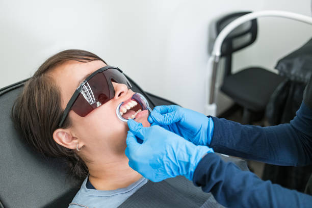 Best Knocked-Out Tooth (Avulsed Tooth) Treatment in Ashley, OH