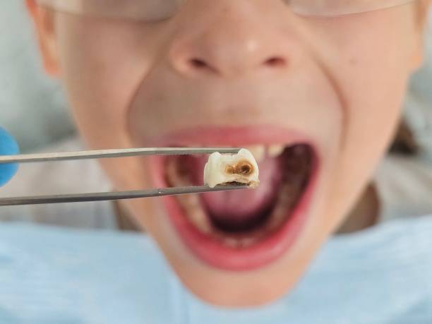 Best Emergency Denture Repair in Ashley, OH