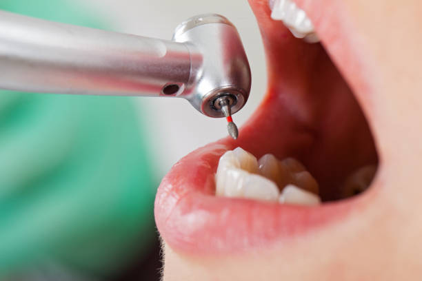 Best Dental Abscess Treatment in Ashley, OH